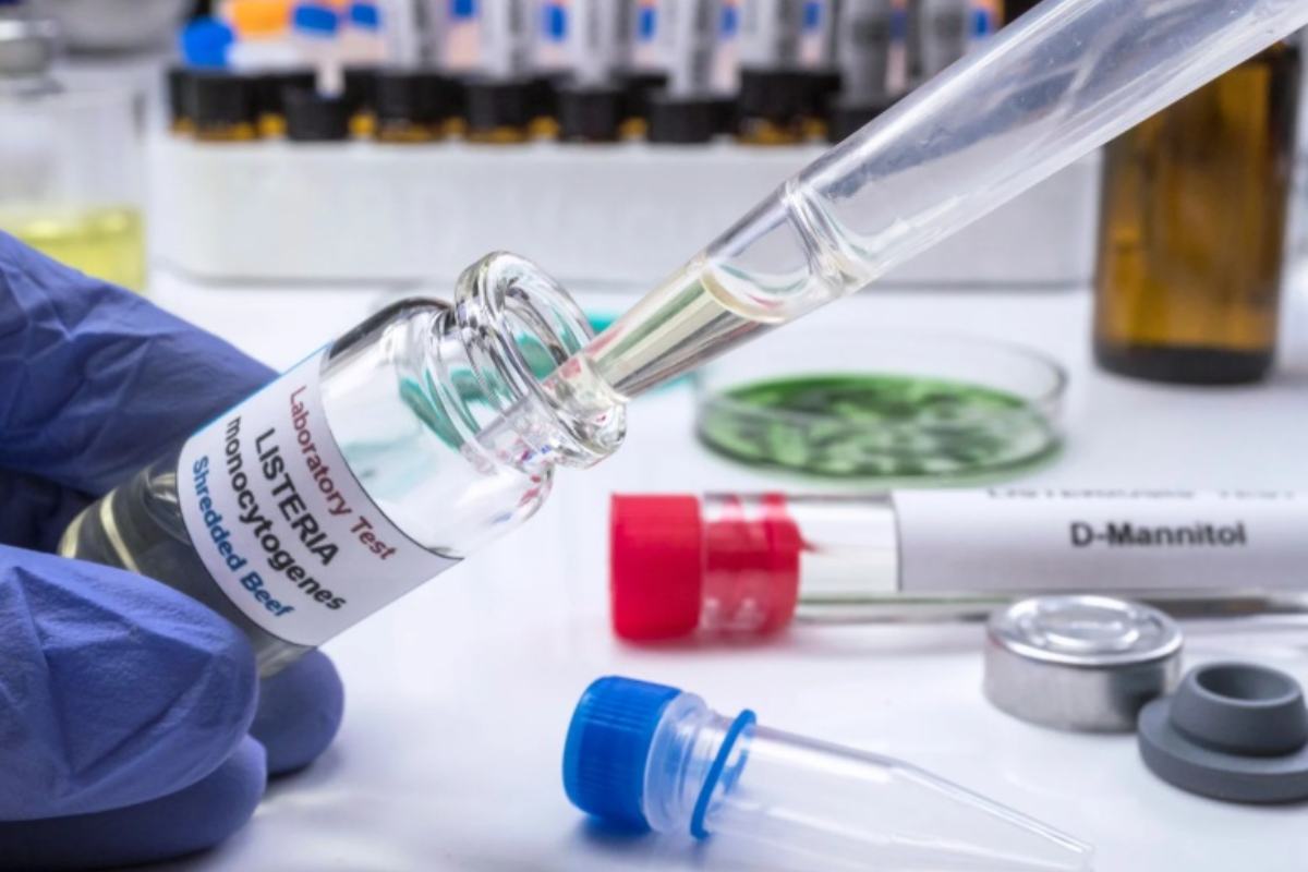 Analisi di laboratorio