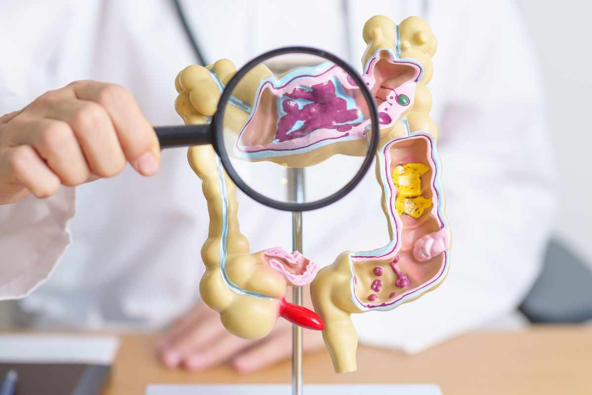 dottore lente ingrandimento intestino