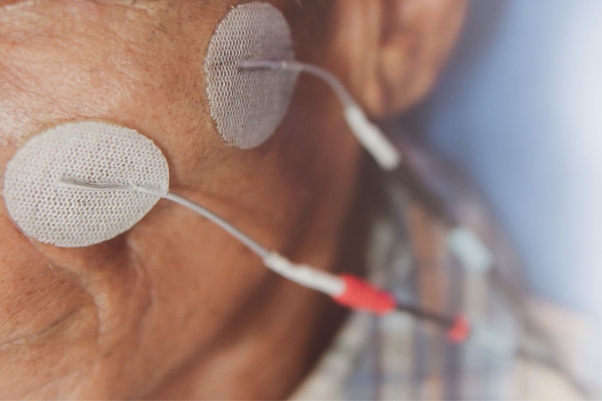 riabilitazione al viso